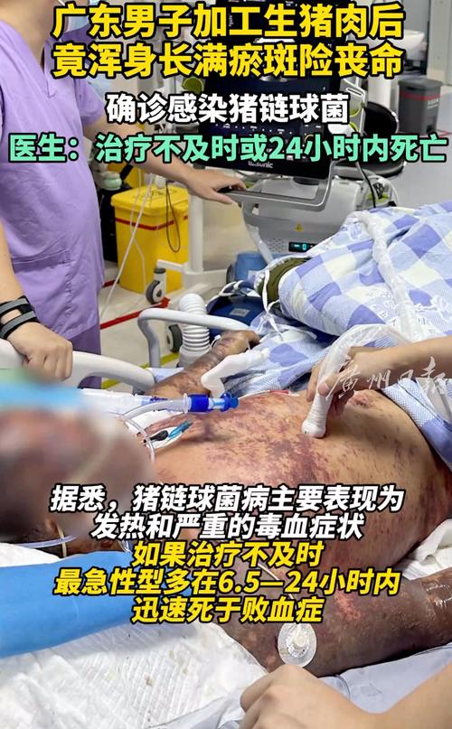 2025年天天开彩免费大全和吃剩菜后被送医抢救与吃剩菜住进icu